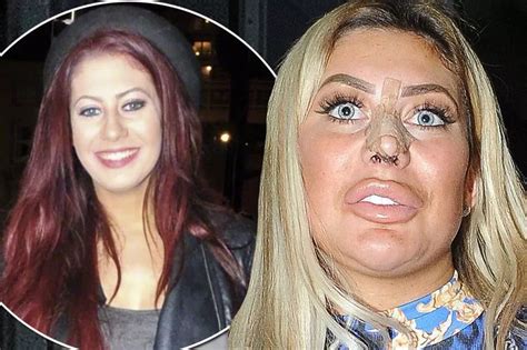 chloe ferry news|chloe ferry before and after.